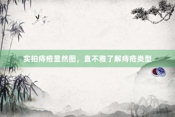 实拍痔疮显然图，直不雅了解痔疮类型